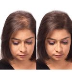 Pachet x 3 Fibre pentru păr rar Sevich, blond, 25 g fotografia produsului View 3 S