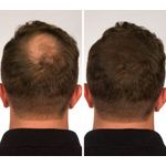 Pachet x 2 Fibre pentru par rar Sevich, blond, 25 g fotografia produsului View 4 S